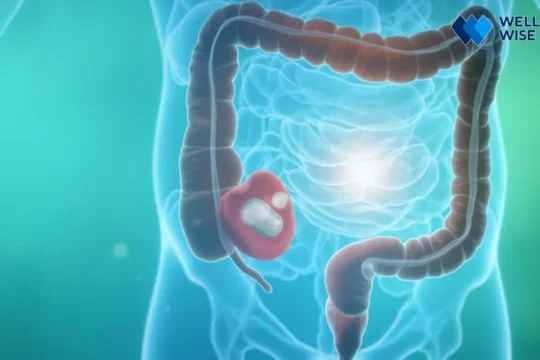Illustration of a calm gut environment representing Rifaximin's targeted action for IBS relief.